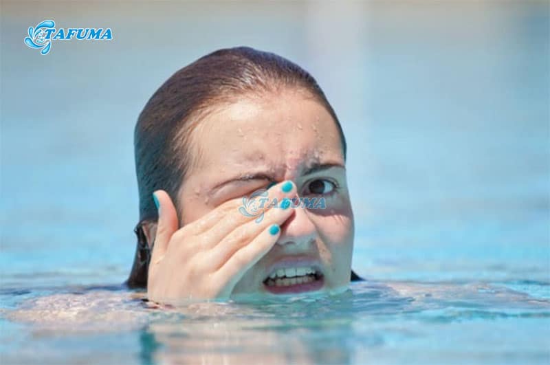 Dùng quá nhiều clo khiến người bơi bị cay mắt